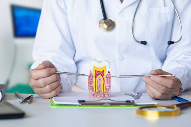 Best Knocked-Out Tooth (Avulsed Tooth) Treatment in Cleveland, MS